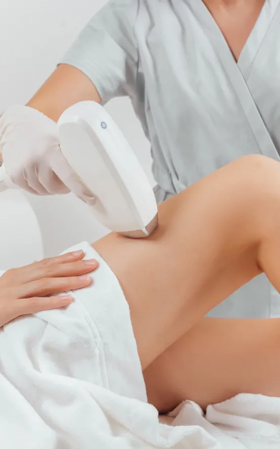 Laser hair removal treatment on a patient’s thigh at a dermatology clinic for smooth, hair-free skin.