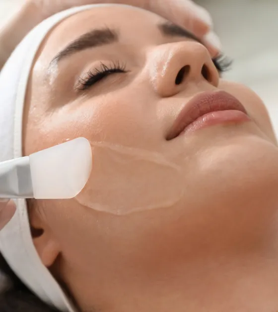 Chemical peel treatment at dermatology clinic for skin rejuvenation, reducing fine lines and improving skin texture.